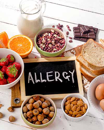 Food Allergies Treatment Near Me in Webster, and Pasadena TX
