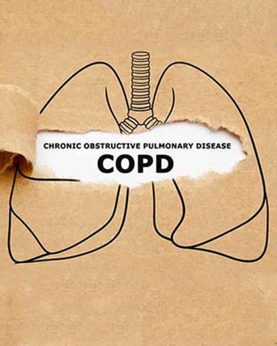 Chronic Obstructive Pulmonary Disease Treatment Near Me in Webster, and Pasadena TX