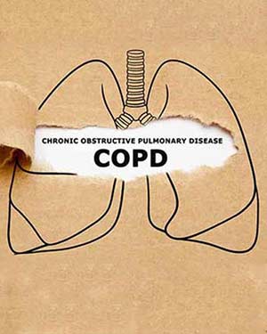 Chronic Obstructive Pulmonary Disease Treatment Near Me in Webster, and Pasadena TX