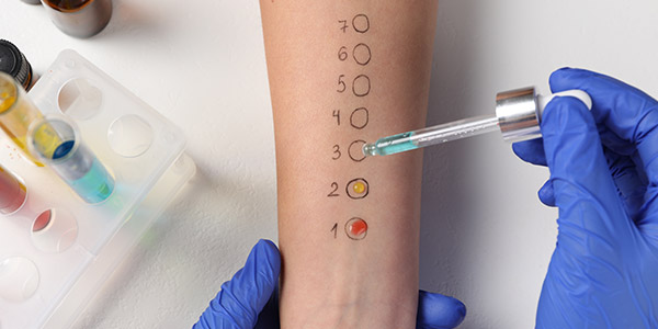 How Much Does Food Allergy Testing Cost in Webster TX?