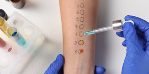 How Much Does Food Allergy Testing Cost in Webster TX?