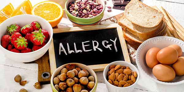 Food Allergy Treatment Specialist Near Me in Webster TX