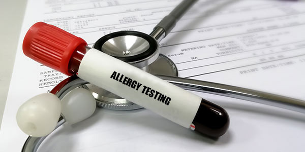 When Should You Get Tested for Allergies Near Me in Webster TX?