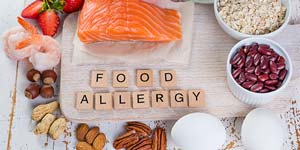 Everything You Need to Know About Diagnosing and Treating Food Allergies Near Me in Webster TX Everything You Need to Know About Diagnosing and Treating Food Allergies Near Me in Webster TX