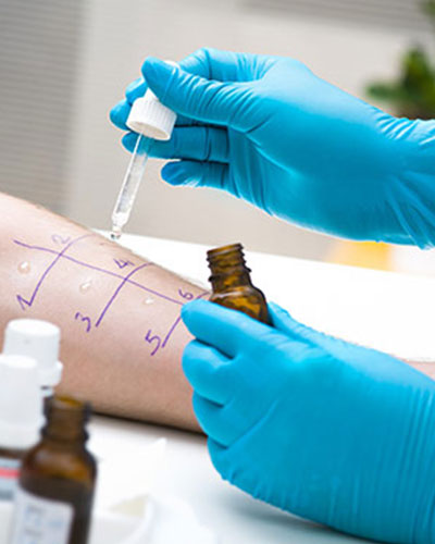 Allergy Testing Clinic Near Me in Webster, and Pasadena TX