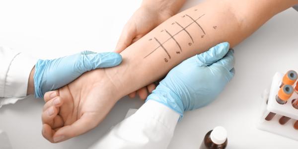 Allergy Testing in Pasadena TX: What It Is, Indications and Types | Primary Care Center of Clear Lake