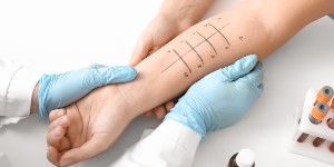Allergy Testing in Pasadena TX: What It Is, Indications and Types | Primary Care Center of Clear Lake