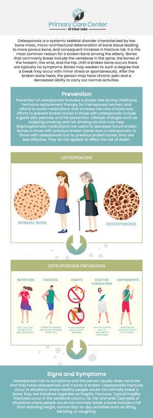 Osteoporosis occurs when bones weaken and become brittle, increasing the risk of fractures. It commonly results from aging, hormonal changes after menopause, low calcium and vitamin D levels, or underlying medical conditions. At Primary Care of Clear Lake, we understand the importance of preventing and managing osteoporosis to ensure our patients maintain strong and healthy bones. Our dedicated team offers comprehensive osteoporosis assessments as part of our commitment to your overall well-being. For more information, please contact us or schedule an appointment online. We have convenient locations to serve you in Webster and Pasadena, TX. 