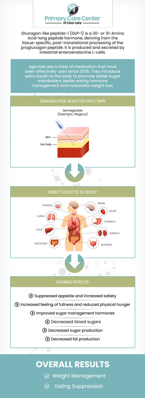 Semaglutide GLP-1 is a weight-loss drug administered intravenously. Semaglutide GLP-1 might facilitate more weight loss than other drugs. It reduces appetite, which is how it works. Semaglutide GLP-1 functions by mimicking the actions of the GLP-1 hormone, which helps control blood sugar levels. Semaglutide GLP-1 injections can lower blood sugar levels, encourage weight loss, and lower the risk of cardiovascular events, among other advantages. Furthering weight loss Injections of Semaglutide GLP-1 are simple to give and frequently well tolerated by patients. If you want to lose medical weight, discuss with our healthcare professional if Semaglutide GLP-1 injections are a good option for you. Our board-certified medical professionals, Dr. Niraj Choudhary, MD, and Dr. Smriti Choudhary, MD, and their team are here to treat you in a soothing environment. Visit our specialists today. For more information, please contact us or schedule an appointment online. We have convenient locations to serve you in Webster and Pasadena, TX. Semaglutide GLP-1 is a weight-loss drug administered intravenously. Semaglutide GLP-1 might facilitate more weight loss than other drugs. It reduces appetite, which is how it works. Semaglutide GLP-1 functions by mimicking the actions of the GLP-1 hormone, which helps control blood sugar levels. Semaglutide GLP-1 injections can lower blood sugar levels, encourage weight loss, and lower the risk of cardiovascular events, among other advantages. Furthering weight loss Injections of Semaglutide GLP-1 are simple to give and frequently well tolerated by patients. If you want to lose medical weight, discuss with our healthcare professional if Semaglutide GLP-1 injections are a good option for you. Our board-certified medical professionals, Dr. Niraj Choudhary, MD, and Dr. Smriti Choudhary, MD, and their team are here to treat you in a soothing environment. Visit our specialists today. For more information, please contact us or schedule an appointment online. We have convenient locations to serve you in Webster and Pasadena, TX.