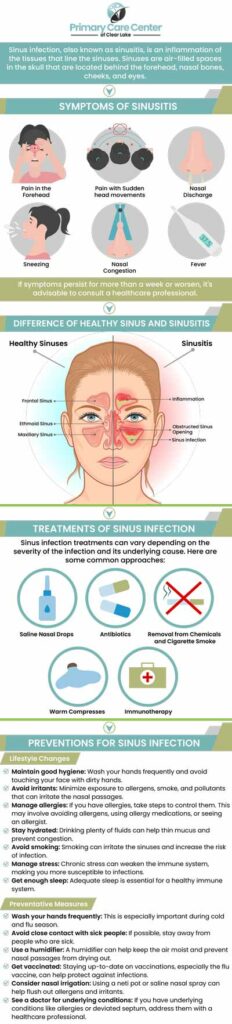 Do you experience a headache, facial pressure or pain, and chronic fatigue? Watery or itchy eyes indicate that you have seasonal allergies, whereas pain or pressure in the face accompanied by a headache and drowsiness usually indicates that you have a sinus infection. Itchy, watery eyes are a good way to tell the difference between allergies and sinus infections. Itching in the eyes is a very rare indication of a sinus infection. Visit Dr. Niraj Choudhary, MD, at Primary Care Center to alleviate your symptoms. We have convenient locations to serve you in Webster and Pasadena, TX. For more information, please contact us or schedule an appointment online. Do you experience a headache, facial pressure or pain, and chronic fatigue? Watery or itchy eyes indicate that you have seasonal allergies, whereas pain or pressure in the face accompanied by a headache and drowsiness usually indicates that you have a sinus infection. Itchy, watery eyes are a good way to tell the difference between allergies and sinus infections. Itching in the eyes is a very rare indication of a sinus infection. Visit Dr. Niraj Choudhary, MD, at Primary Care Center to alleviate your symptoms. We have convenient locations to serve you in Webster and Pasadena, TX. For more information, please contact us or schedule an appointment online.